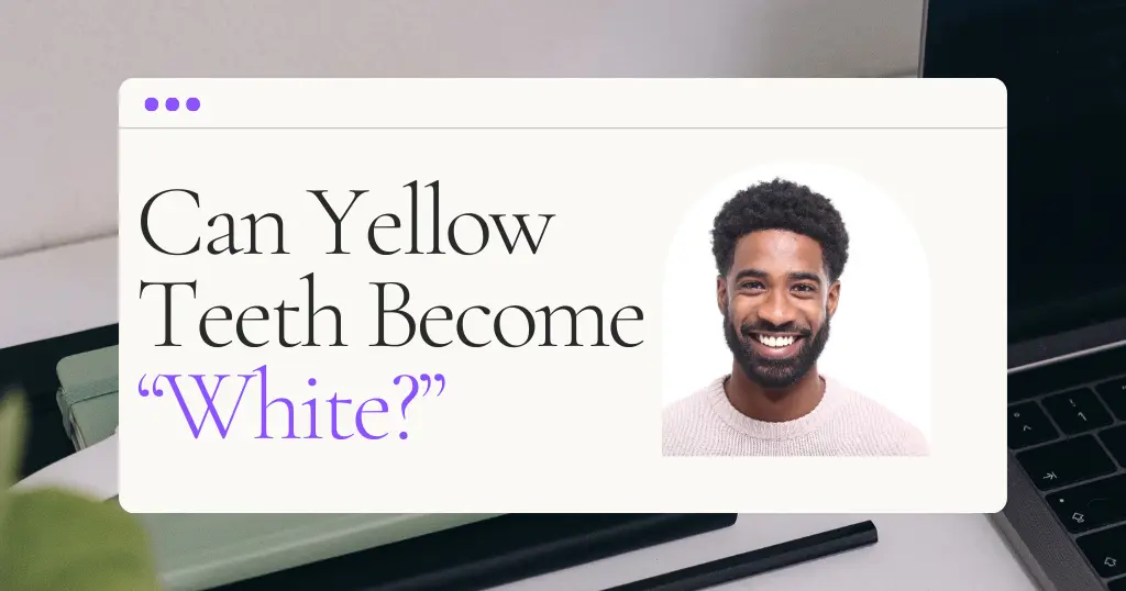 Yellow Teeth White Blog Header Image