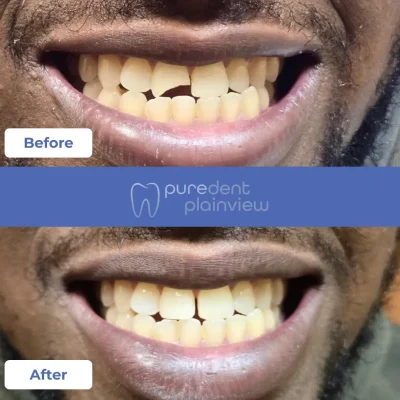 Cosmetic Before And After